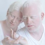 Journée internationale de sensibilisation à l’albinisme 2023